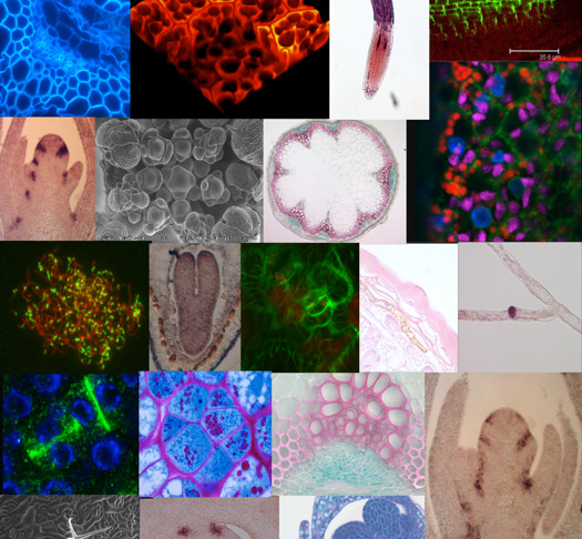 Quelques exemples d’imageries du Végétal sur la plate-forme OV- Cytologie/Imagerie