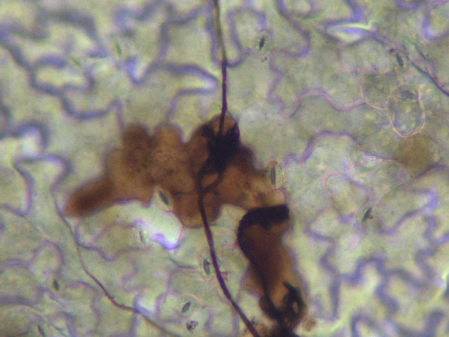 Epiderme d’Arabidopsis infecté par Botrytis cinerea. La coloration au DAB révèle l'accumulation d'espèces réactives de l'oxygène (ROS) dans les cellules de la plante et du champignon