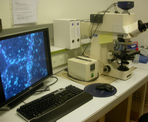 : Observation au microscope de feuilles colorées au bleu d’aniline permettant de révéler les zones d’accumulation d’un polysaccharide spécifique des réactions de défense, la callose, dans une feuille infectée