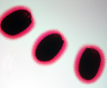 Pectines de la couche interne du mucilage d’Arabidopsis colorées au rouge de ruthénium