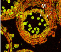 Grains de pollen dans une section d’anthère de colza