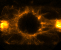 A PPB in a root cell beginning to divide