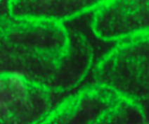 Localisation des protéines pour une sous-unité catalytique de cellulose synthase dans des cellules épidermiques des téguments en développement