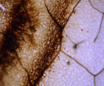 Détail d’une feuille d’A. thaliana infectée par B. cinerea. Une coloration brune permet de révéler les zones d’accumulation des espèces réactives de l’oxygène dans les hyphes fongiques et dans certaines cellules de la feuille.
