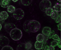 Centromeres and nuclear enveloppes of cells located within an anther at the stage of meiosis (A. thaliana)