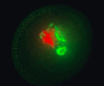 Grain de pollen d’Arabidopsis