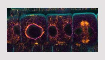 École d’été "Imagerie végétale avancée" à la plateforme le Cytologie/Imagerie IJPB dans le cadre du réseau SPS