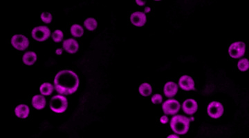 Une nouvelle méthode d’imagerie cellulaire non-invasive révèle la structure des gouttelettes lipidiques