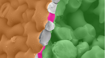Premières preuves scientifiques que les nanofilaments extracellulaires manipulent la forme des cellules