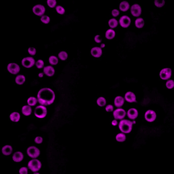 Une nouvelle méthode d’imagerie cellulaire non-invasive révèle la structure des gouttelettes lipidiques