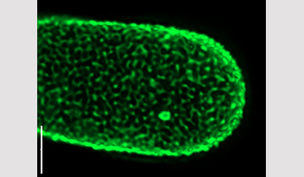 Quand pectines et protéines s’associent : un nouveau mécanisme d’assemblage de la paroi végétale