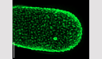 When pectins and proteins meet: a new mechanism for assembling the plant wall