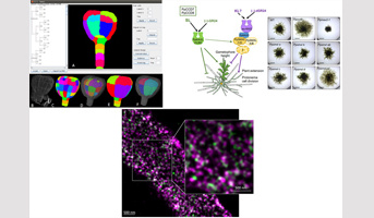 IJPB Highlights from Life Sciences at Paris-Saclay University