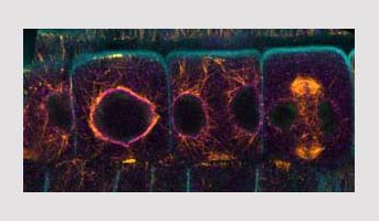 École d’été "Imagerie végétale avancée" à la plateforme le Cytologie/Imagerie IJPB dans le cadre du réseau SPS