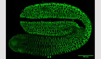 Le remodelage des xyloglucanes dans la paroi cellulaire joue un rôle essentiel dans la germination de la graine