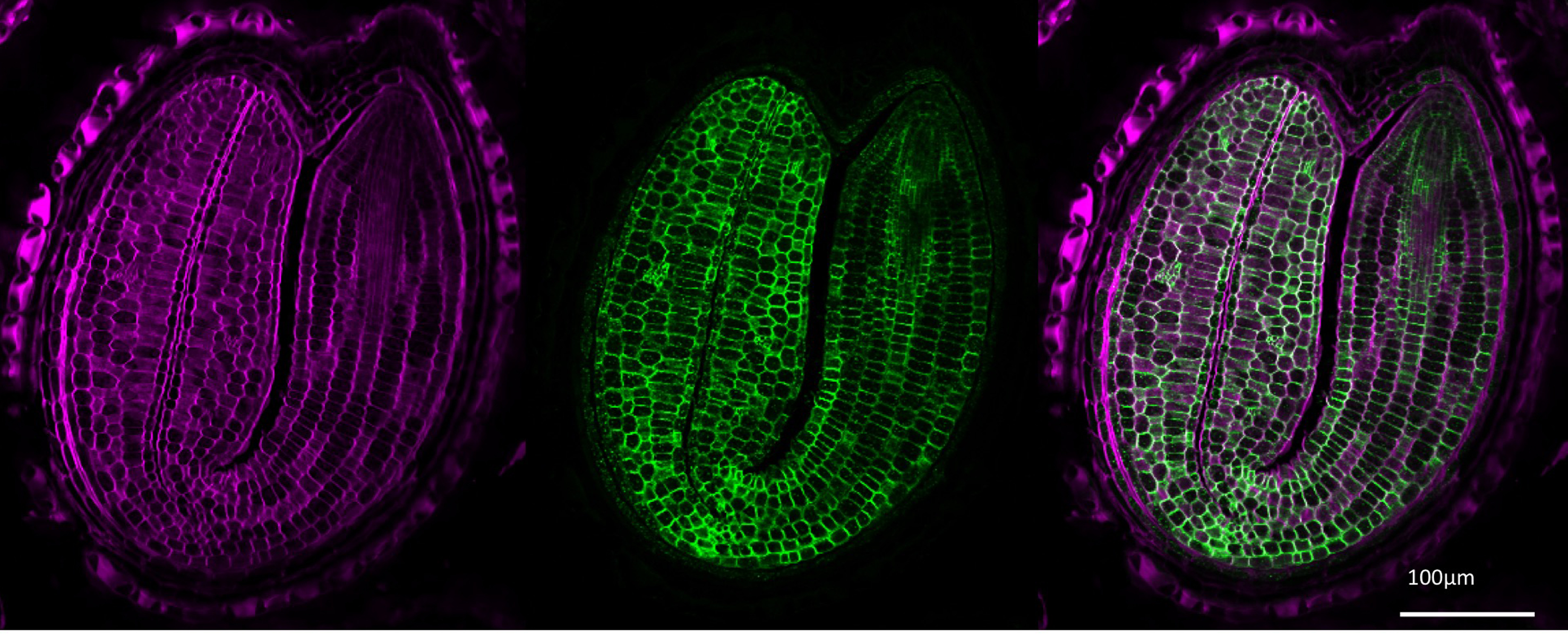 Immunolocalisation et coloration des polysaccharides dans une coupe de graine d’Arabidopsis en développement