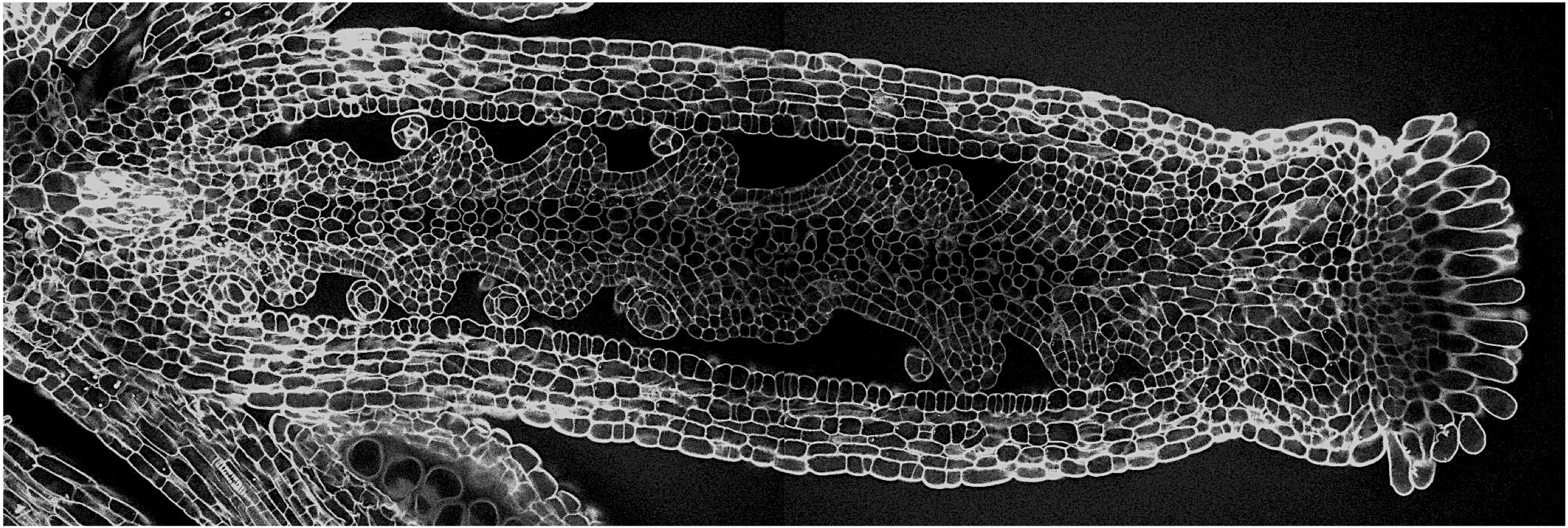 Pistil d'Arabidopsis thaliana (microscopie confocale)