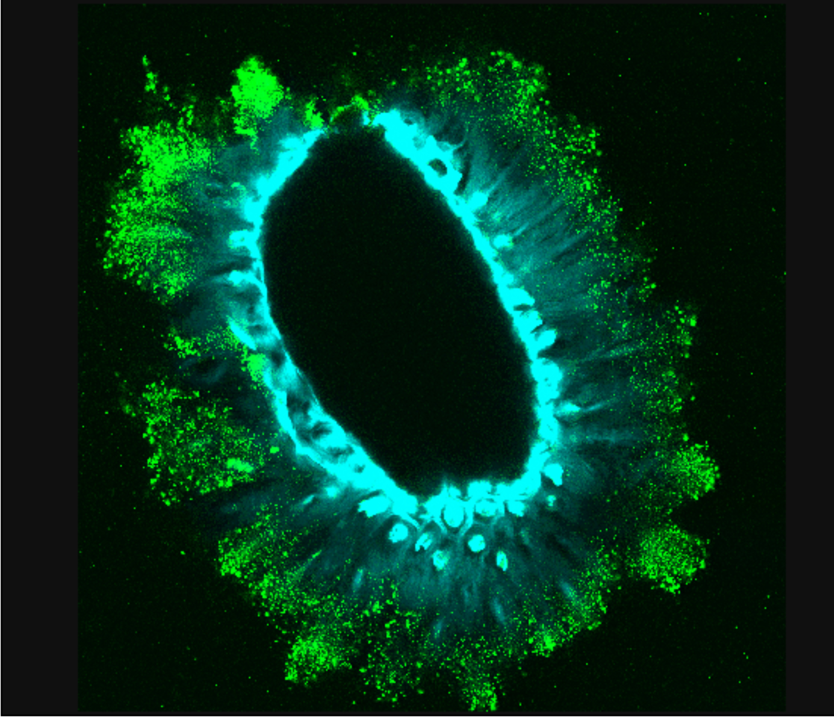Immunolocalisation et coloration des polysaccharides du mucilage d’une graine d’Arabidopsis